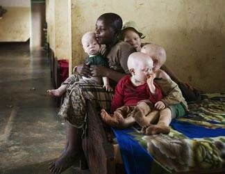  2016/11/albinos_324x250.jpg 